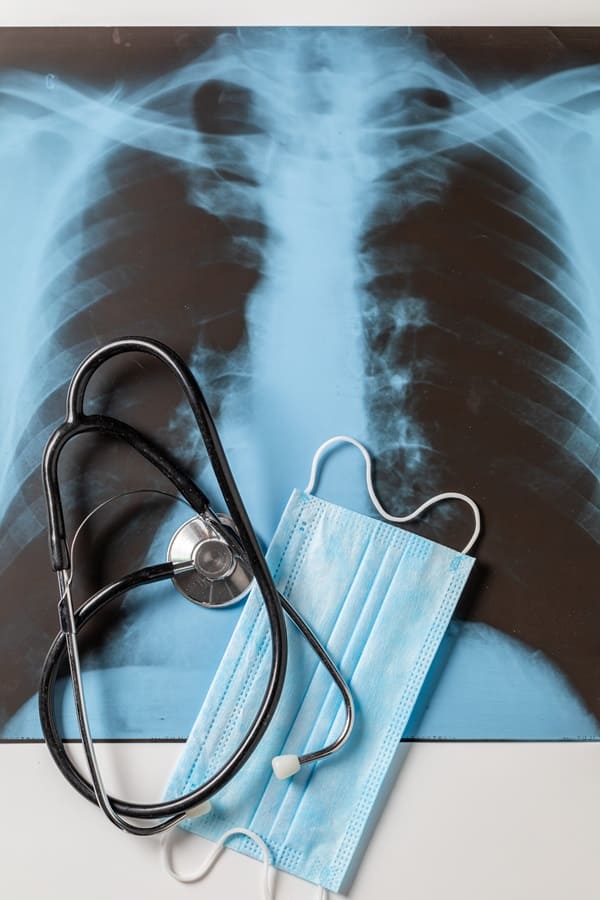 Servicio de urología para cálculos renales en Bogotá