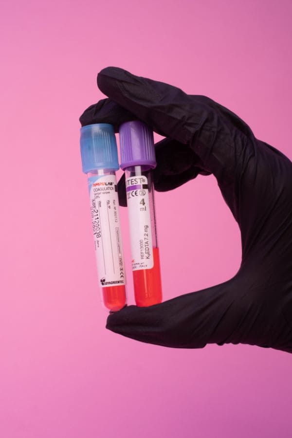 Servicio de urología para cálculos renales en Bogotá