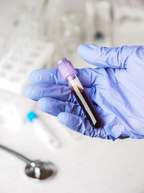 Servicio de urología para cálculos renales en Bogotá